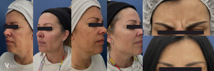 Centro de Medicina Estética Facial en Valdemoro